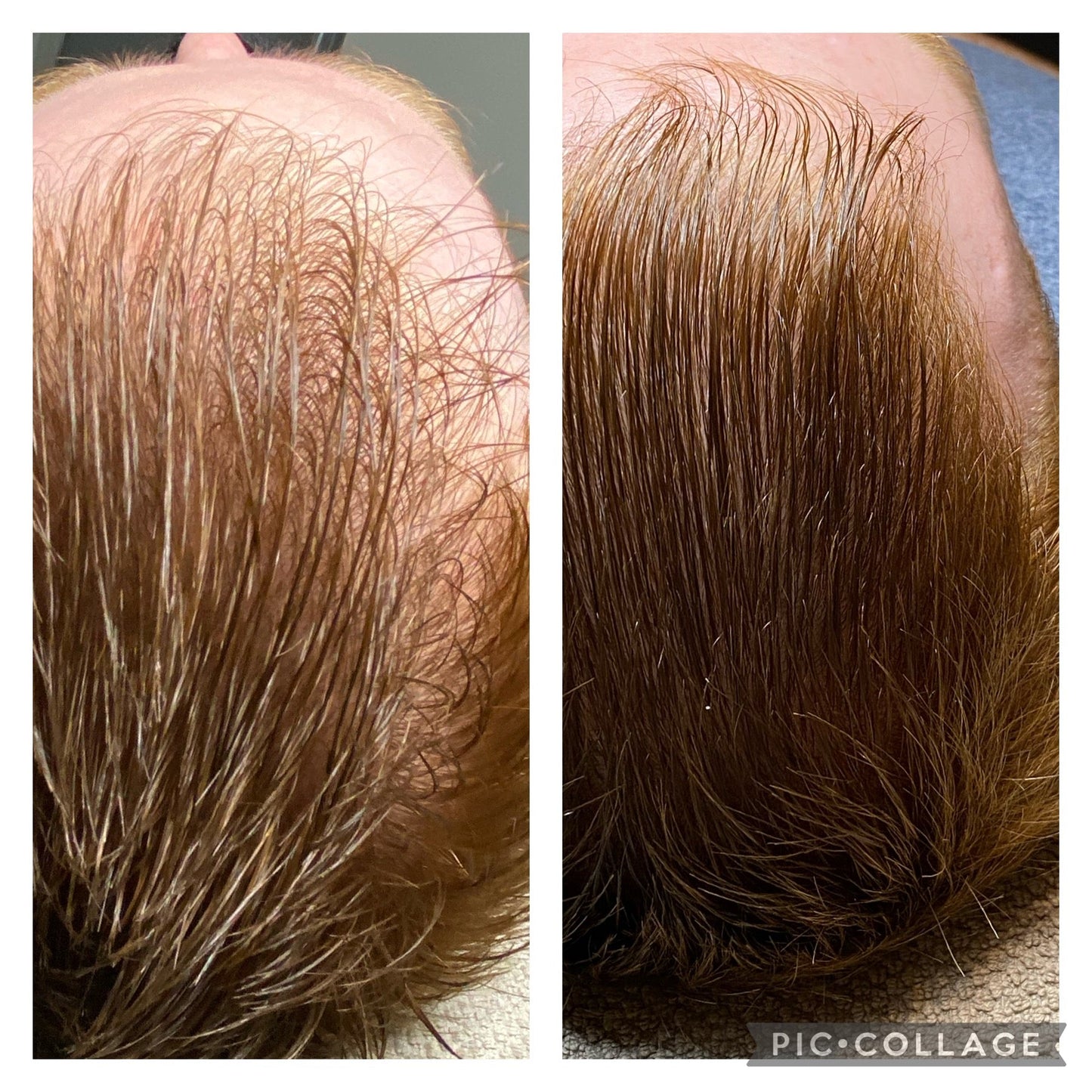 HYDRAFACIAL KERAVIVE sans sérum à la maison