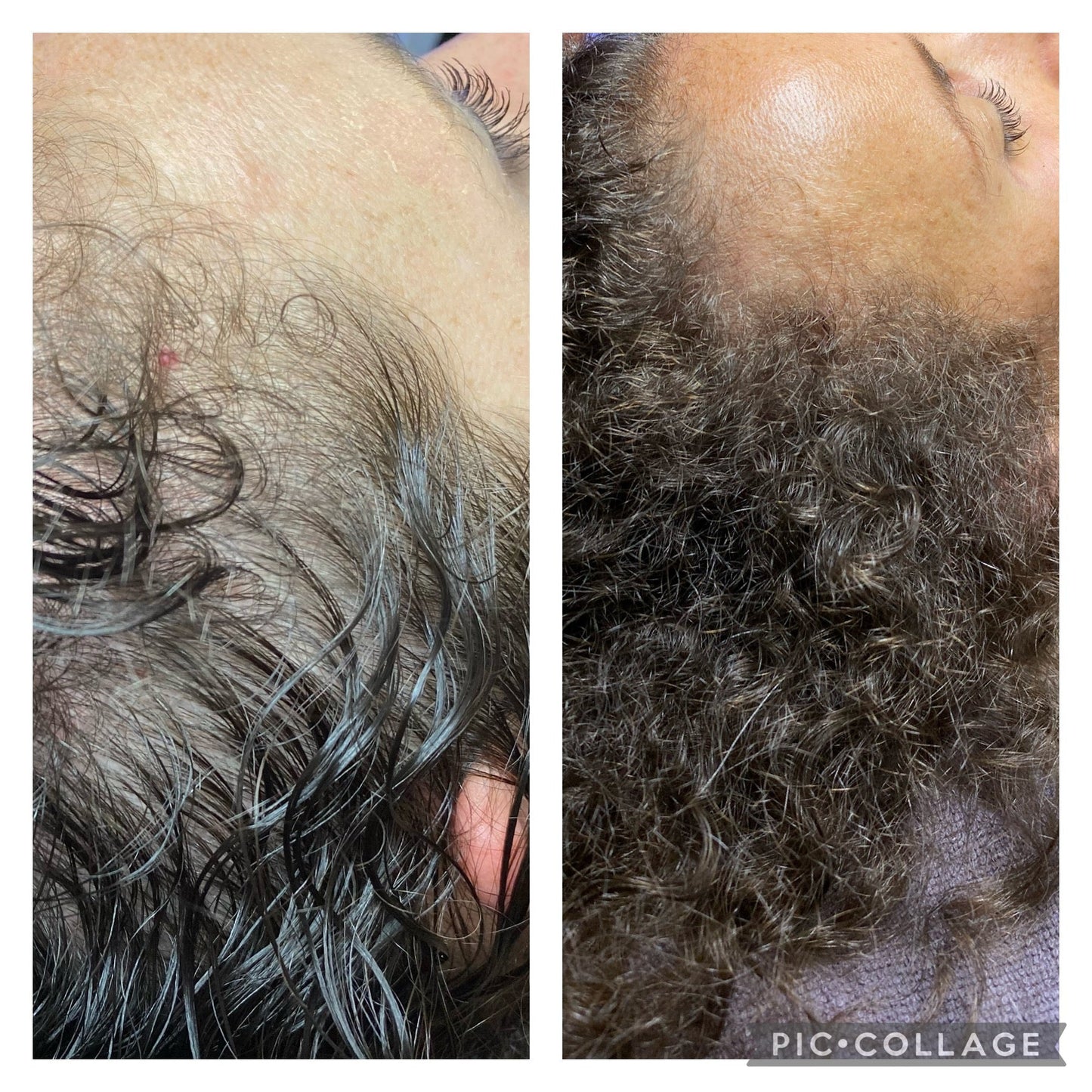 HYDRAFACIAL KERAVIVE sans sérum à la maison