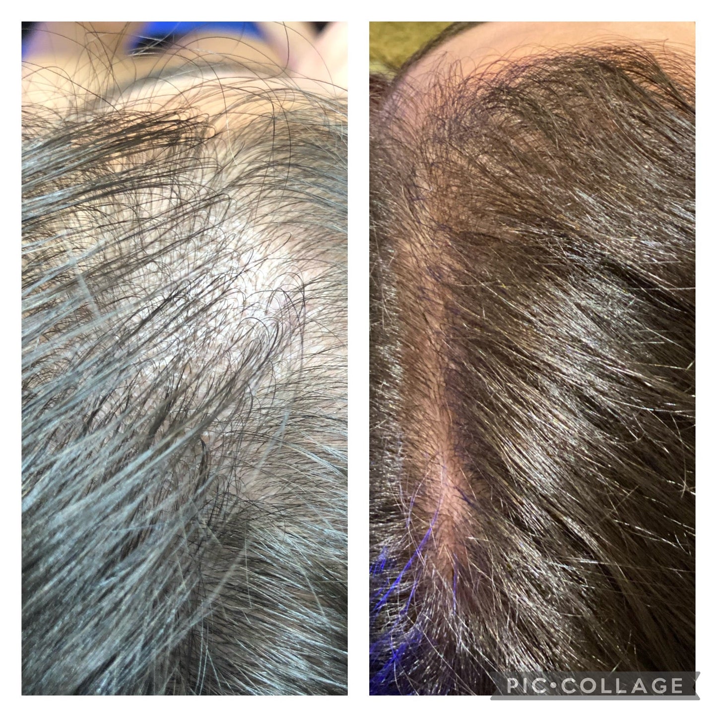 HYDRAFACIAL KERAVIVE sans sérum à la maison