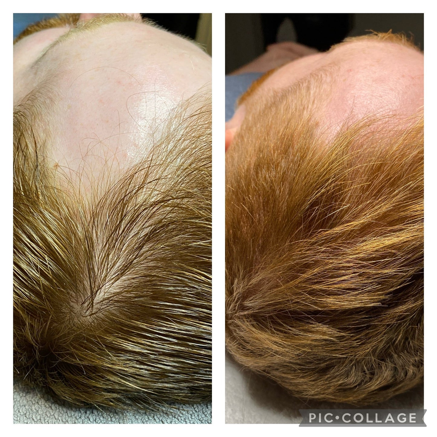 HYDRAFACIAL KERAVIVE sans sérum à la maison