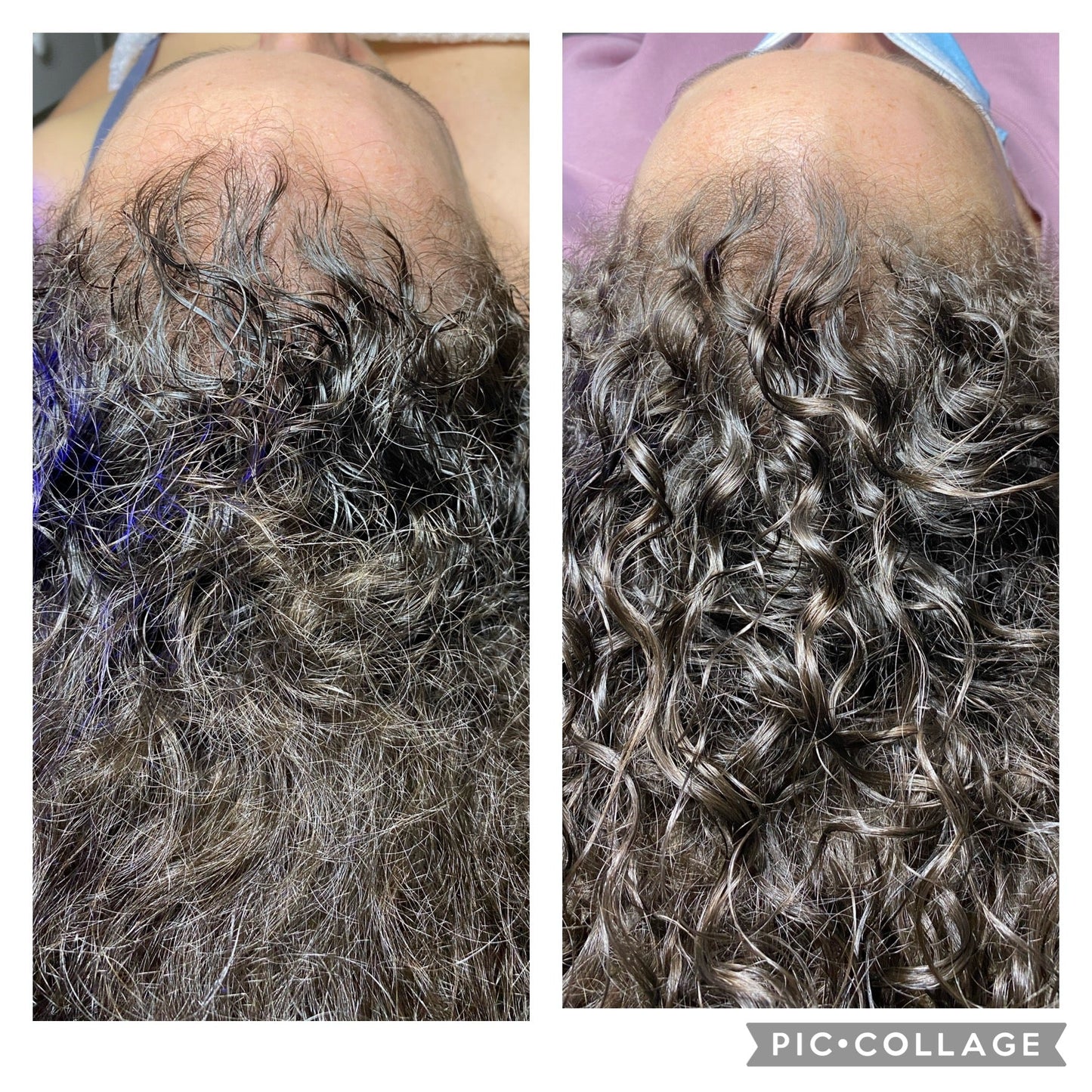 HYDRAFACIAL KERAVIVE sans sérum à la maison