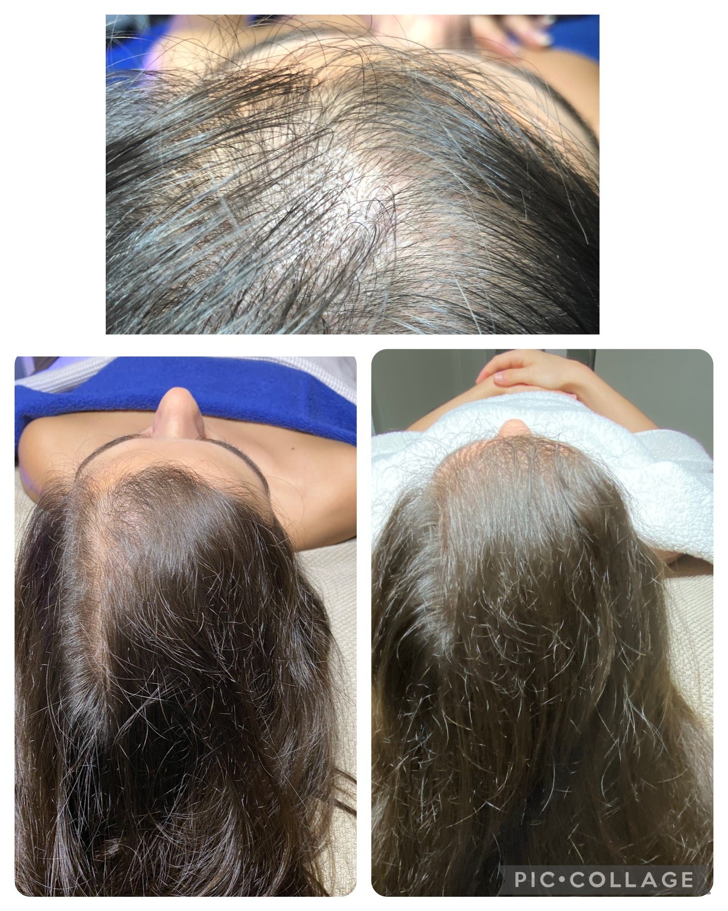 HYDRAFACIAL KERAVIVE avec sérum à la maison