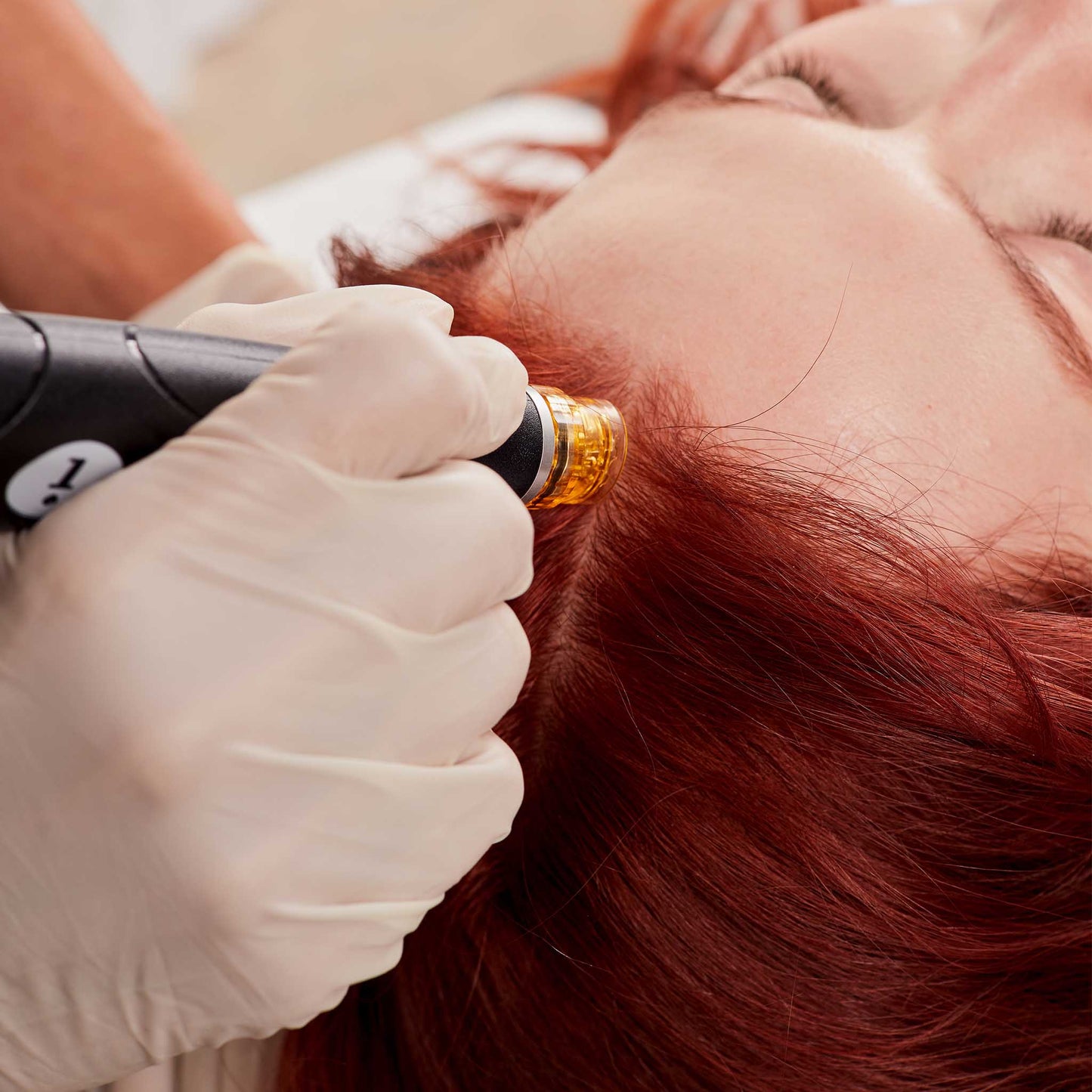 HYDRAFACIAL KERAVIVE Exfoliation du cuir chevelu - Soins - Josée Dubé Spa Urbain - boutique en ligne - Rosemont - Montréal